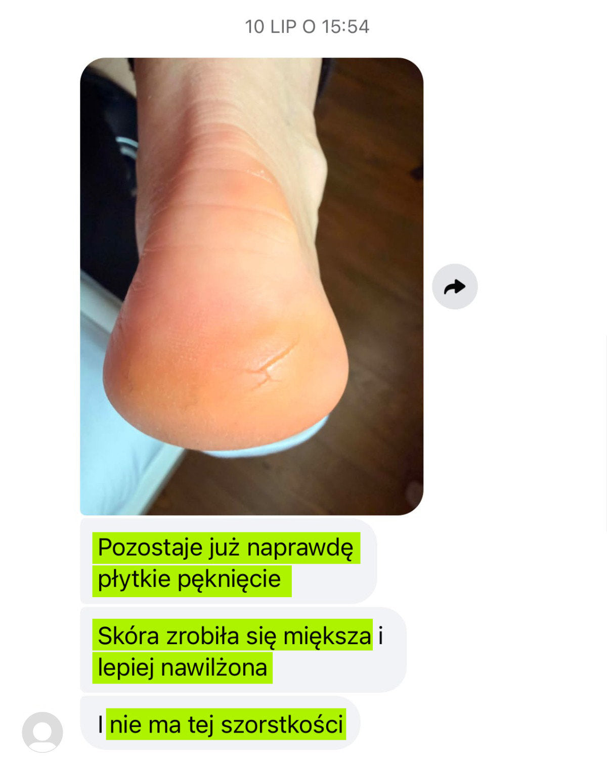 Wiadomość od klientki z 10 lipca: zdjęcie pięty po 27 dniach stosowania RAW. Skóra zrobiła się miększa i lepiej nawilżona.