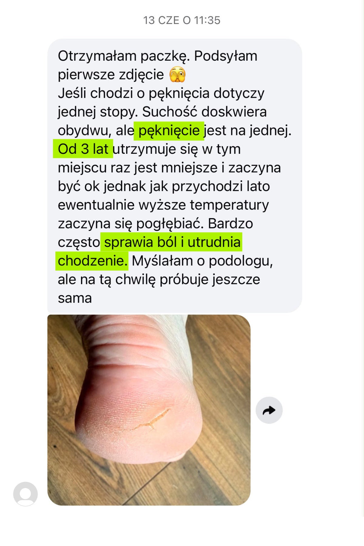 Wiadomość od klientki z 13 czerwca: zdjęcie pękniętej pięty przed stosowaniem RAW.